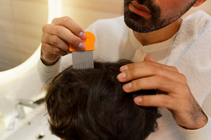 Purifying 45-Minute Anti-Dandruff Treatment Experience at Zivaya Spa, Wyndham Grand, Udaipur